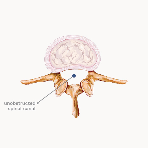 Healthy Spine→